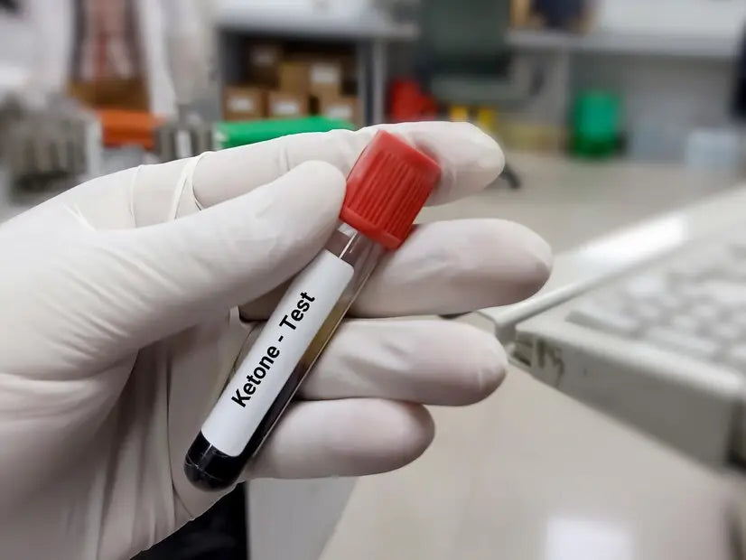 Diabetic Ketoacidosis: A Complete Guide For Individuals With Diabetes Image