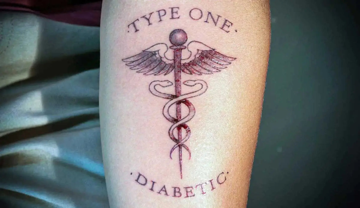 type 1 diabetic with a tattoo on the forearm  Image