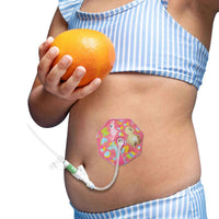 pediatric g tube pad pink worn by child soft protective pad for stoma comfort and daily skin protection